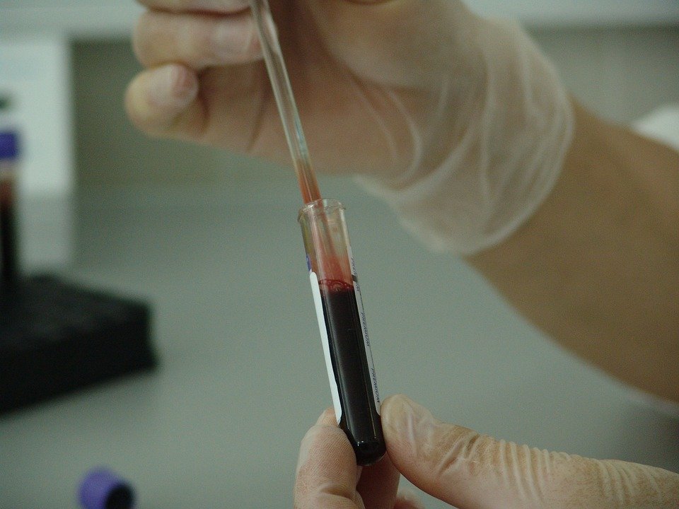 Benefits of pharmaceutical engineering